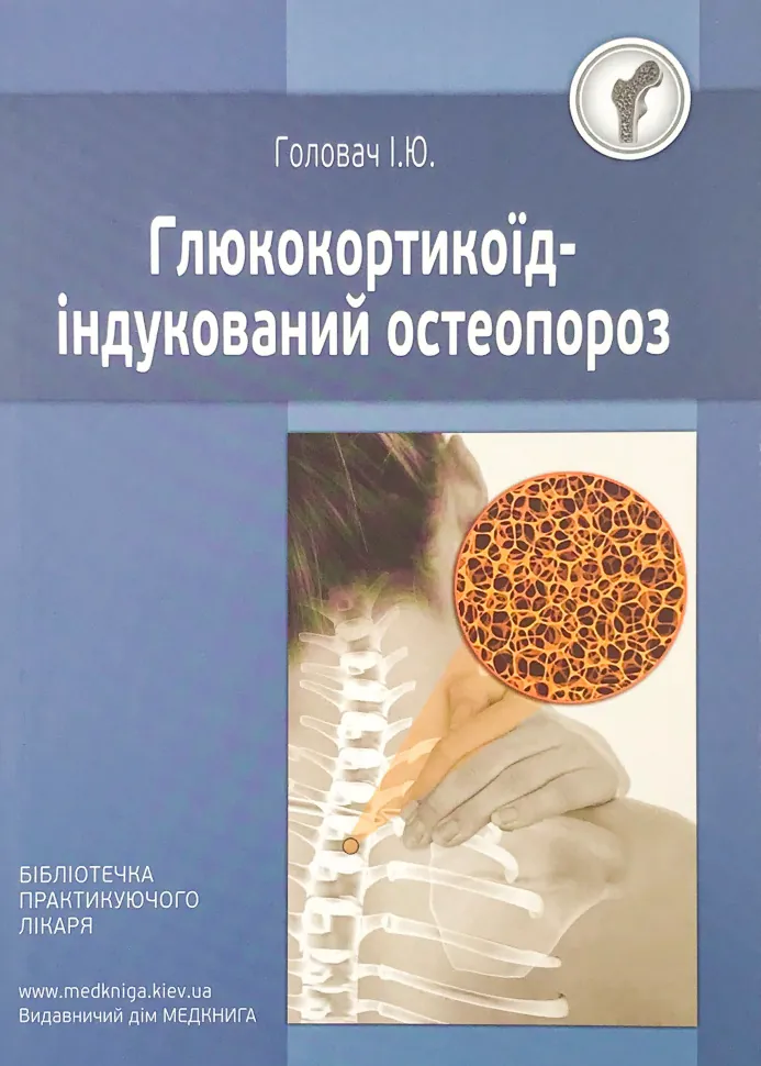 Глюкокортикоїд-індукований остеопороз. Автор — Головач І.Ю.. Обкладинка — м'яка