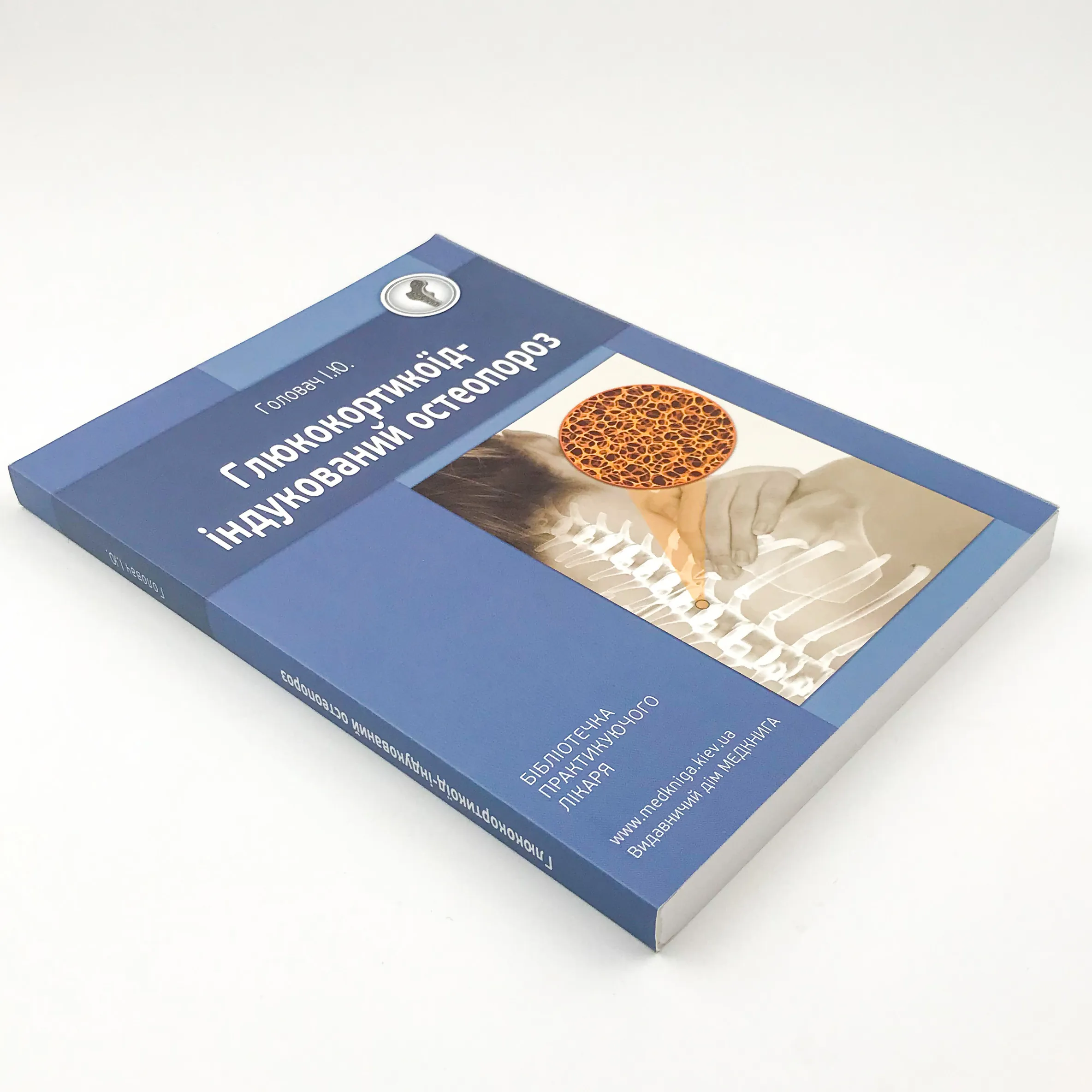 Глюкокортикоїд-індукований остеопороз