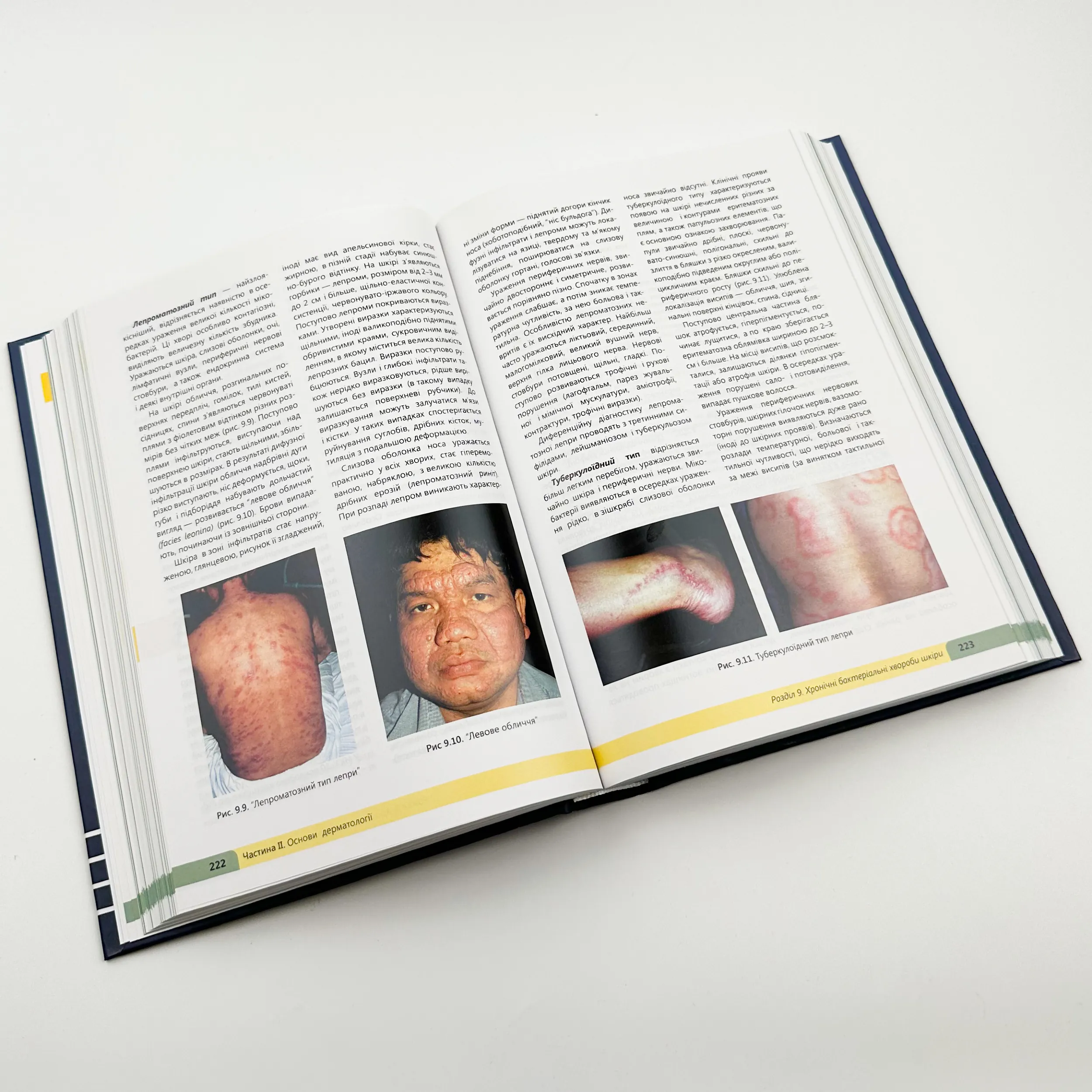 Дерматологія. Венерологія . Автор — Свистунов І.В.. 