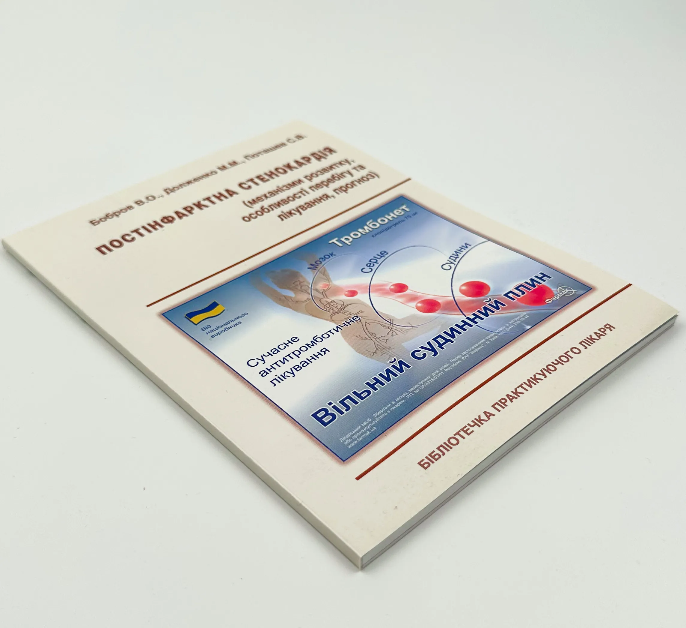 Постінфарктна стенокардія