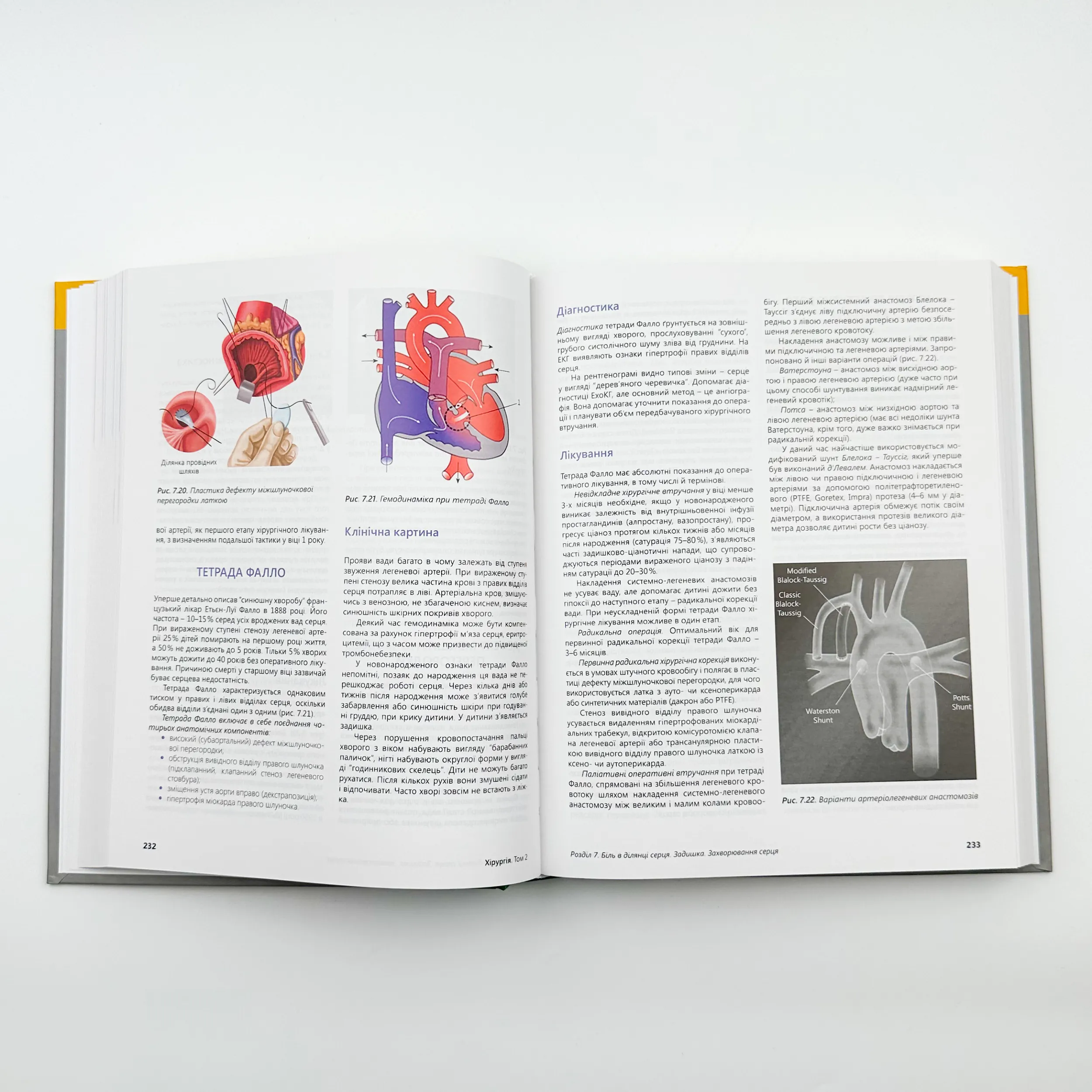 Хірургія. Т.2. . Автор — Кондратенко П.Г.. 