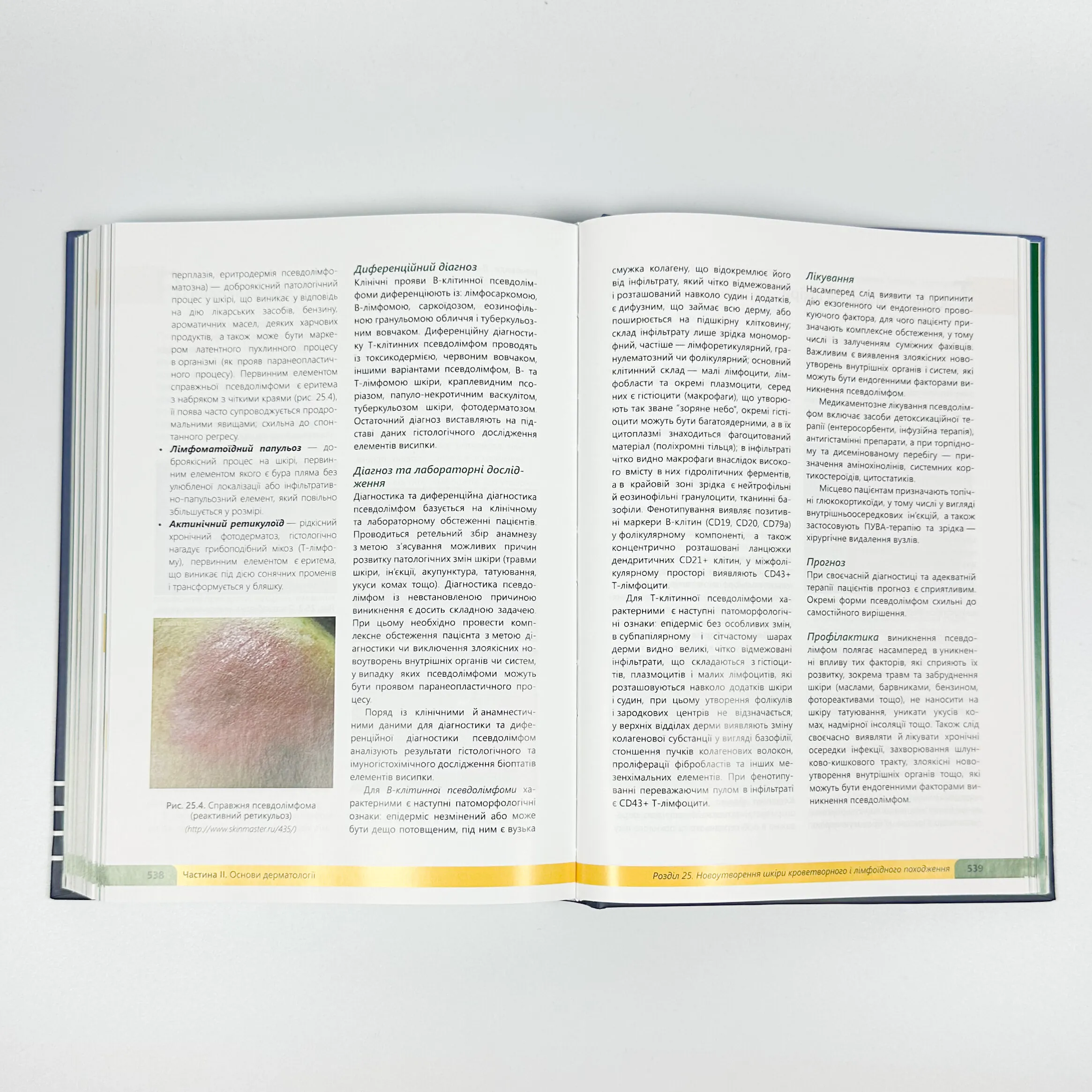 Дерматологія. Венерологія = Dermatology. Venereology: атлас укр. та англ. мовами. Автор — Свистунов І.В., Святенко А.В.. 