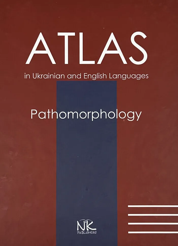 Патоморфологія = Pathomorphology: атлас укр. та англ. мовами. Автор — Боднар Я.Я., Багрій М.М.. Обложка — твердая