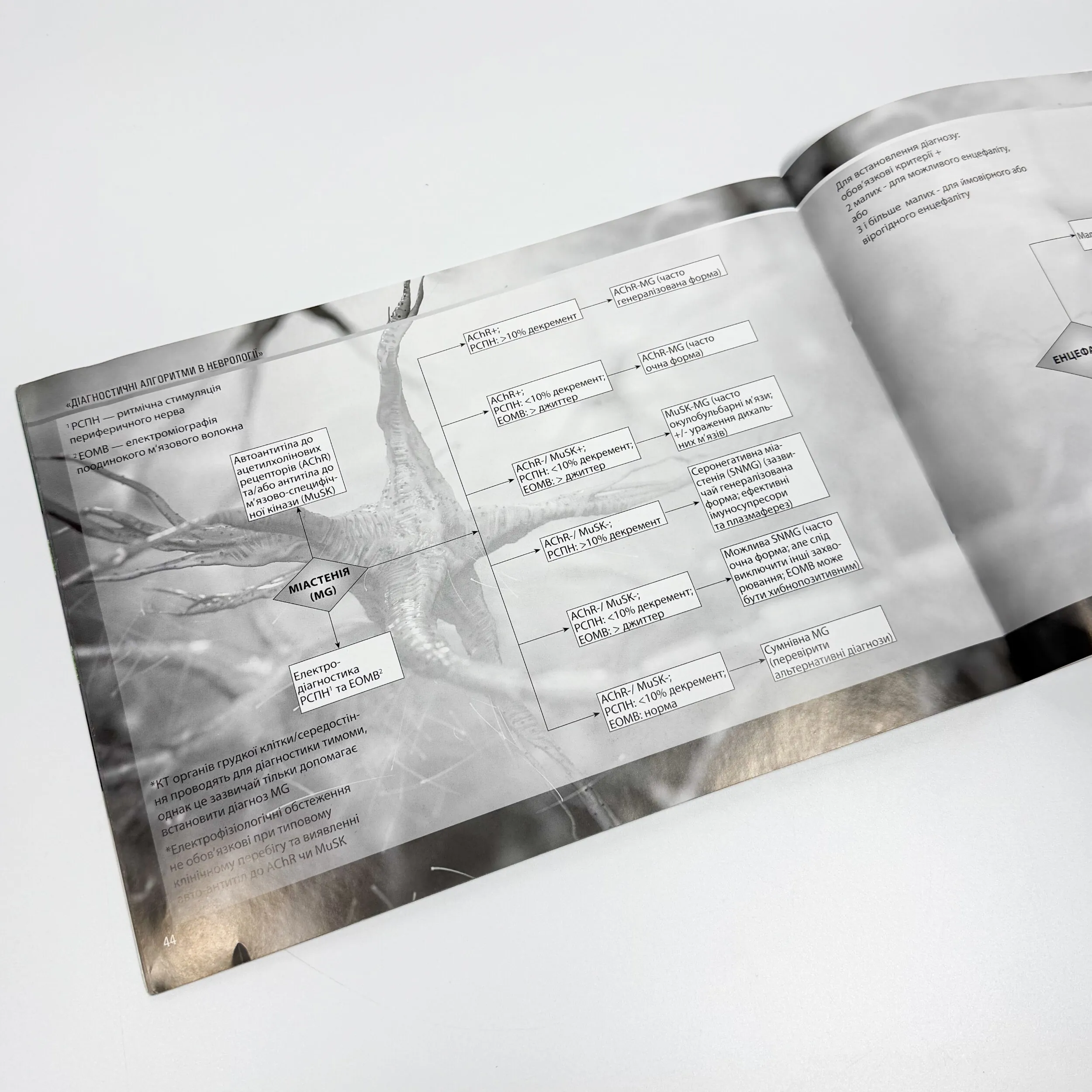 Діагностичні алгоритми в неврології 