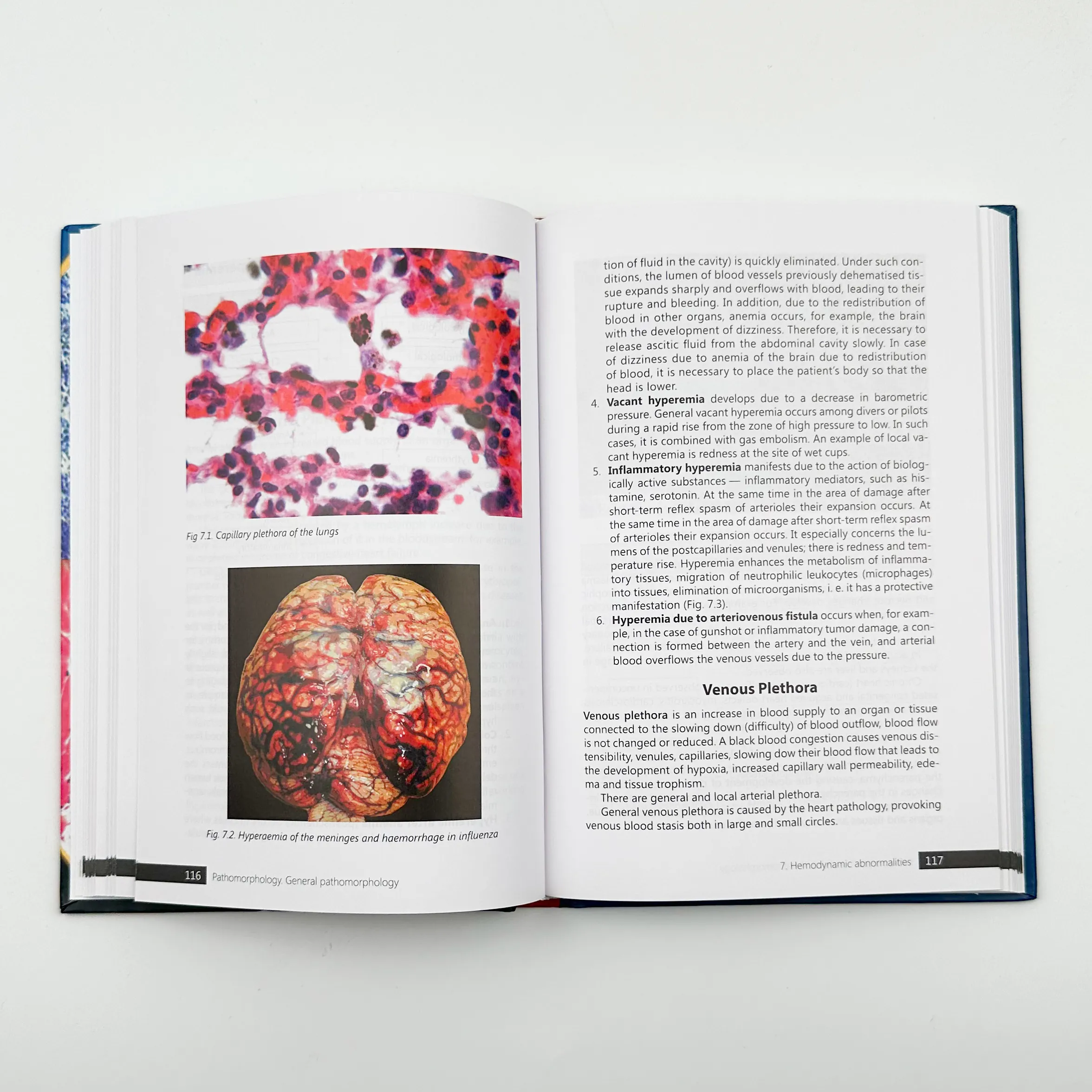 Pathomorphology. General Pathomorphology . Автор — Боднар Я.Я.. 