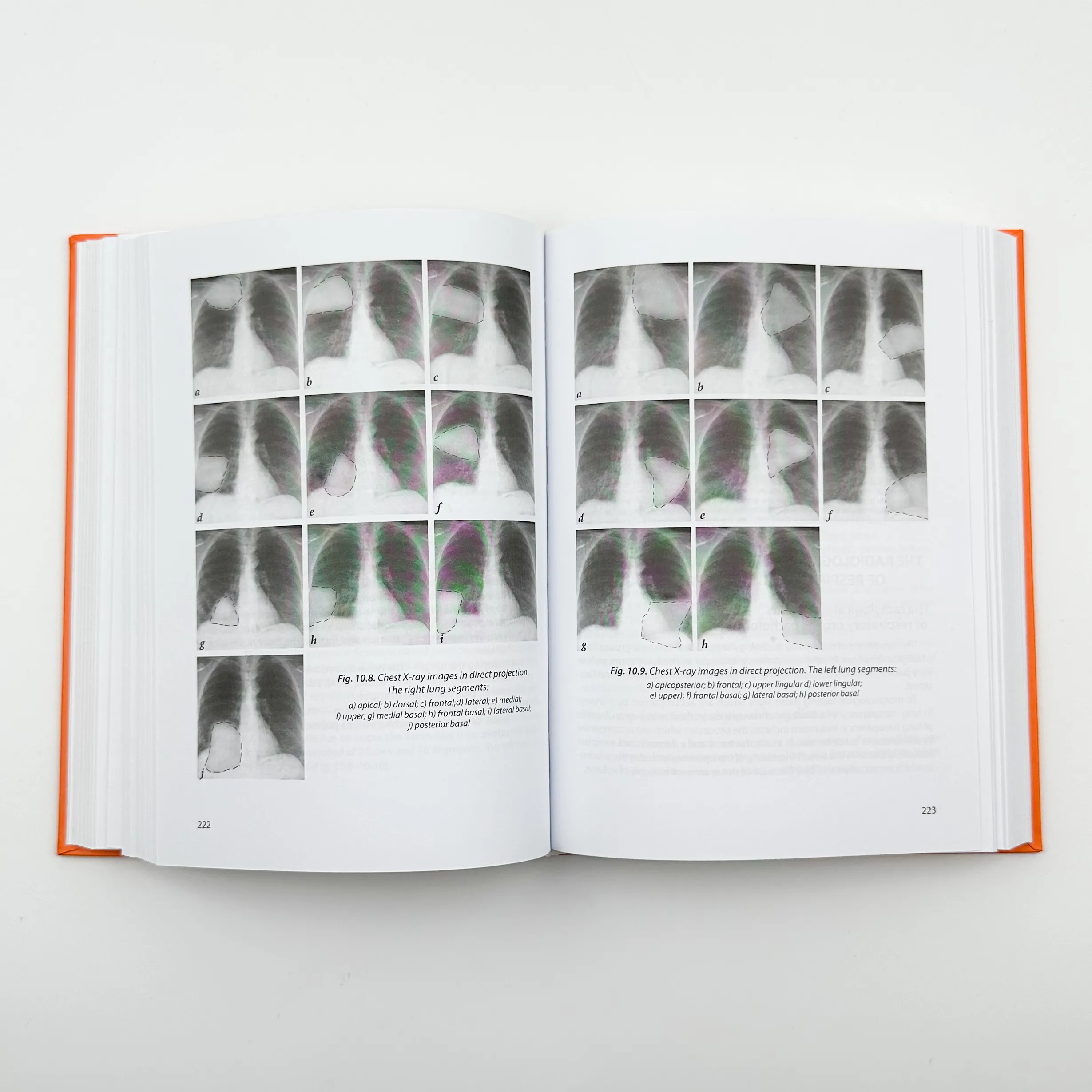 Radiology. Radiotherapy. Diagnostic Imaging. Автор — М.П. Ковальський. 