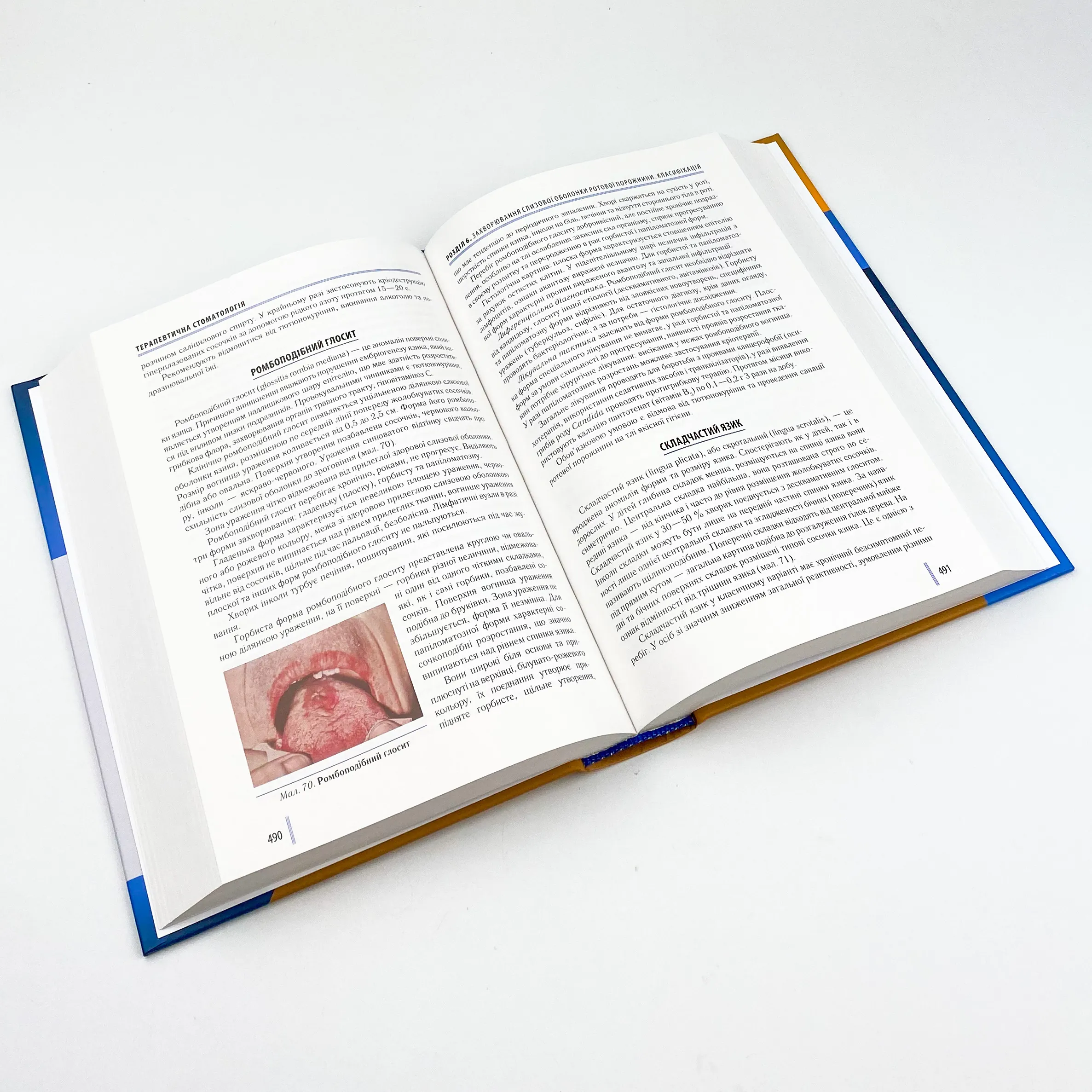 Стоматологія. Книга 2. Автор — М.М Рожко, І.І Кириленко, О.Г Денисенко. 