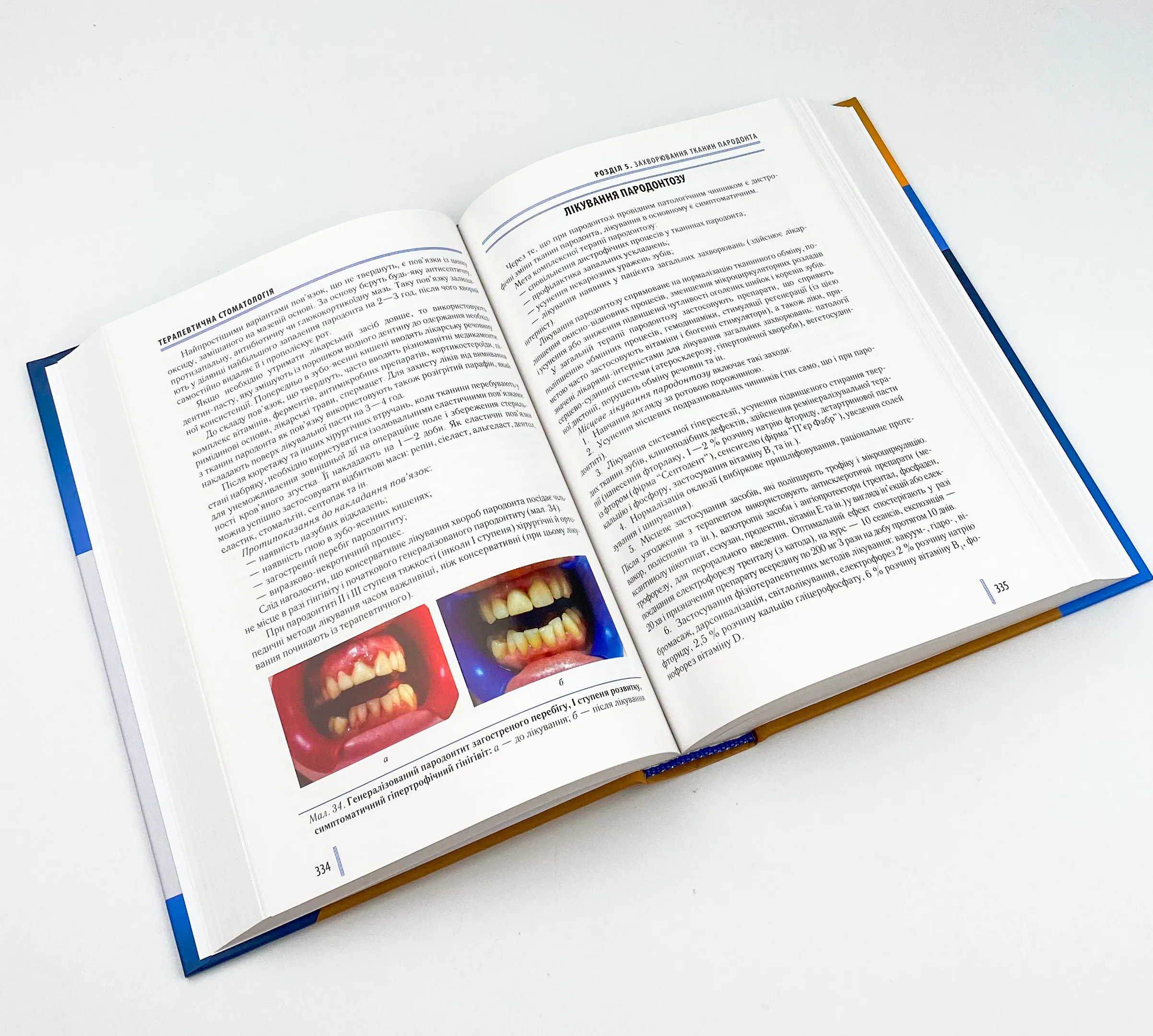 Стоматологія. Книга 2. Автор — М.М Рожко, І.І Кириленко, О.Г Денисенко. 