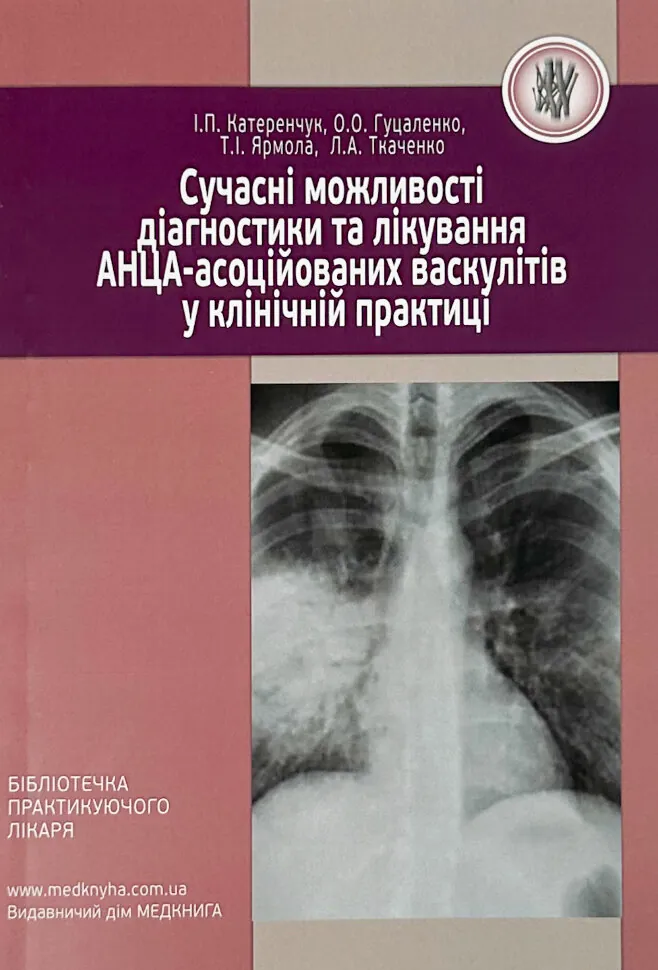 Сучасні можливості діагностики та лікування АНЦА-асоційованих васкулітів у клінічній практиці. Автор — Гуцаленко Л.В., Катеренчук І.П.. Обложка — мягкая