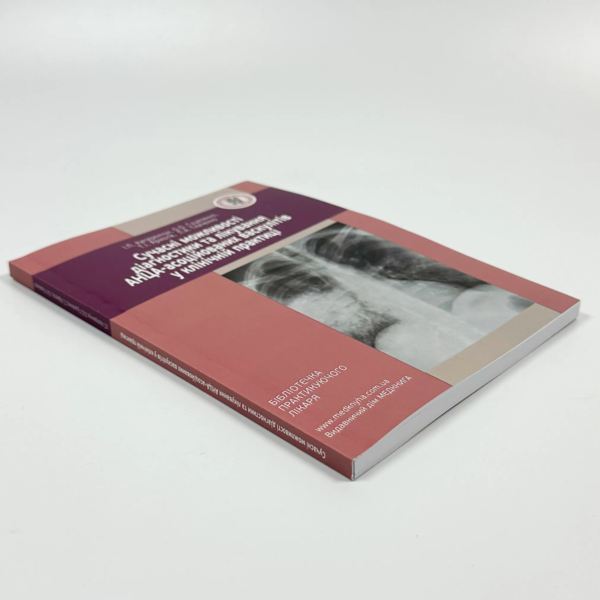 Сучасні можливості діагностики та лікування АНЦА-асоційованих васкулітів у клінічній практиці