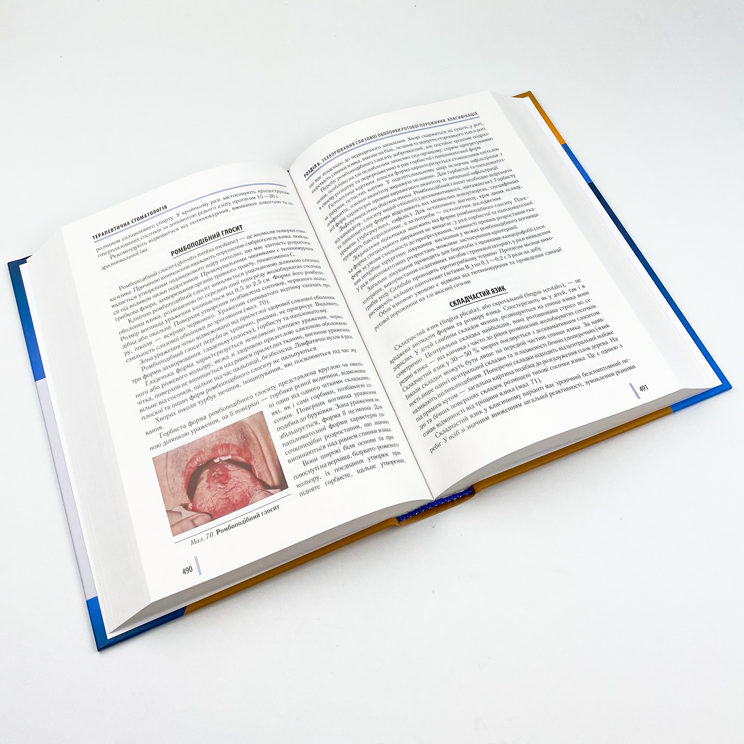 Стоматологія. Книга 2. Автор — М.М Рожко, І.І Кириленко, О.Г Денисенко. 