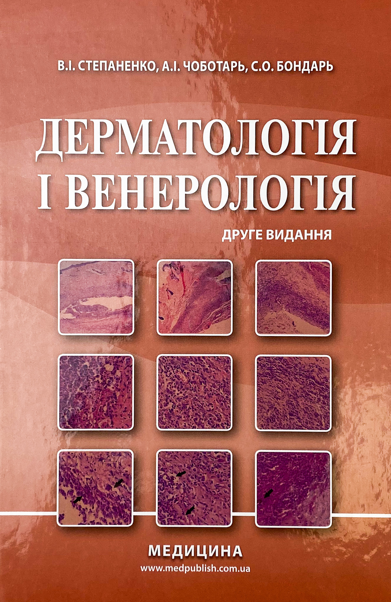 Дерматологія і венерологія. Автор — В.І Степаненко, А.І Чоботарь, С.О Бондарь. 