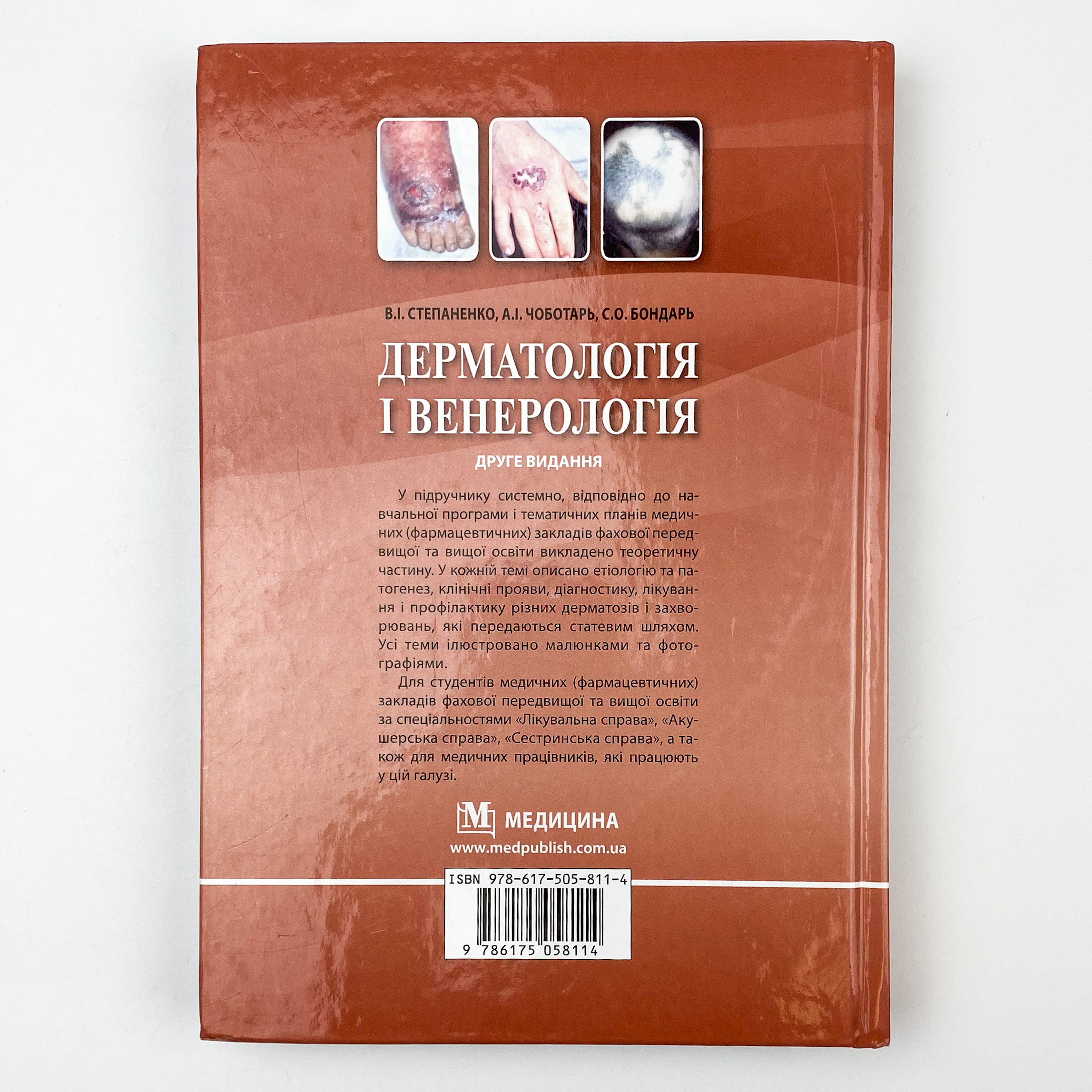 Дерматологія і венерологія. Автор — В.І Степаненко, А.І Чоботарь, С.О Бондарь. 